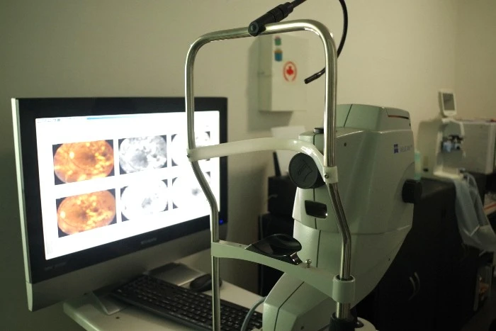 Atención para ojo rojo en Tlalnepantla