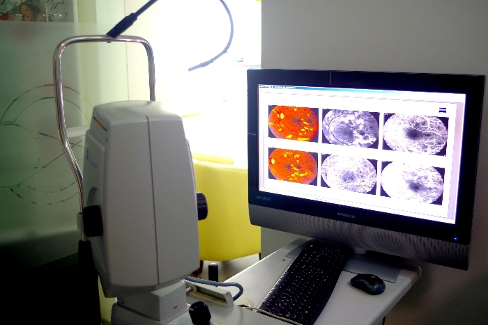 Catarata y glaucoma en Tlalnepantla